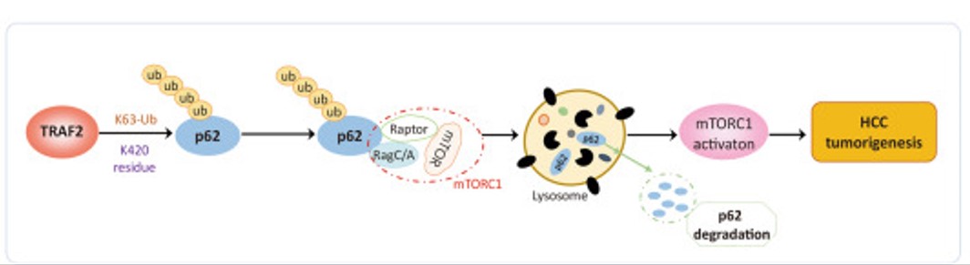 A model for TRAF2 in liver tumorigenesis.jpg